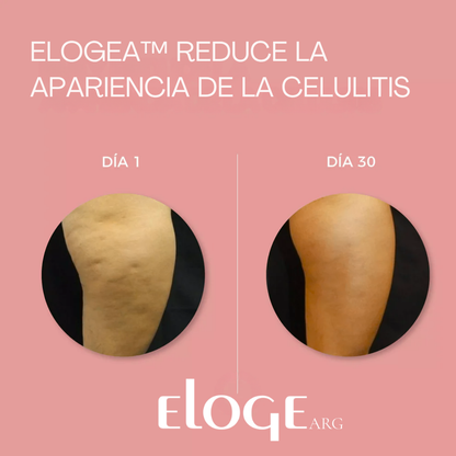 2x1 Aceite de Masaje Anti-Celulitis